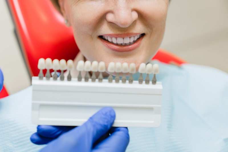 Dentist choosing selecting color of patient`s teeth for whitening at clinic.